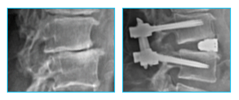 Washington_radiographs