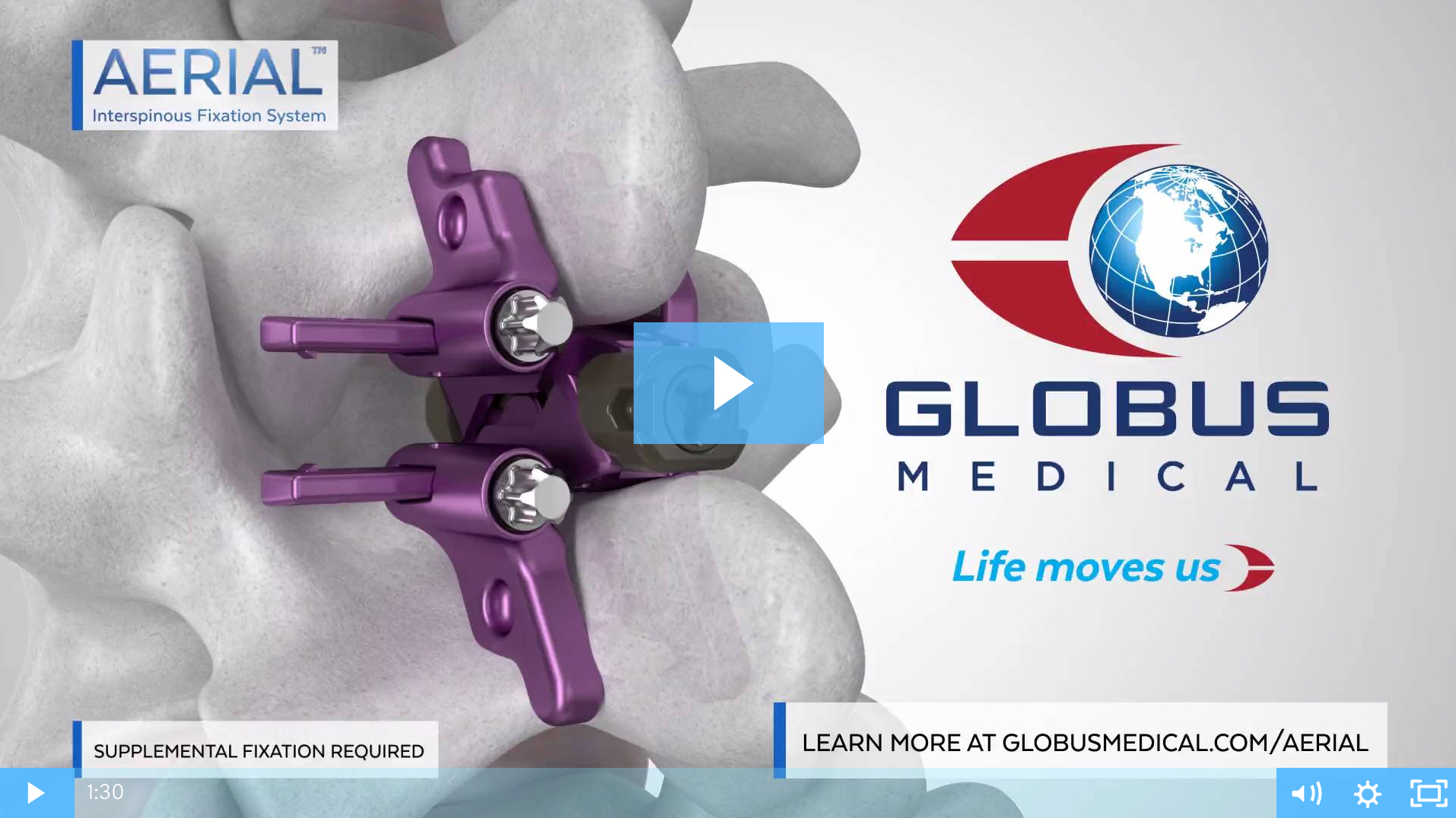 AERIAL™ Expandable Interspinous Fixation System