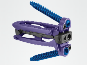 Elsa Instruments Requirements ELSA™ Product Page - Expandable Technology