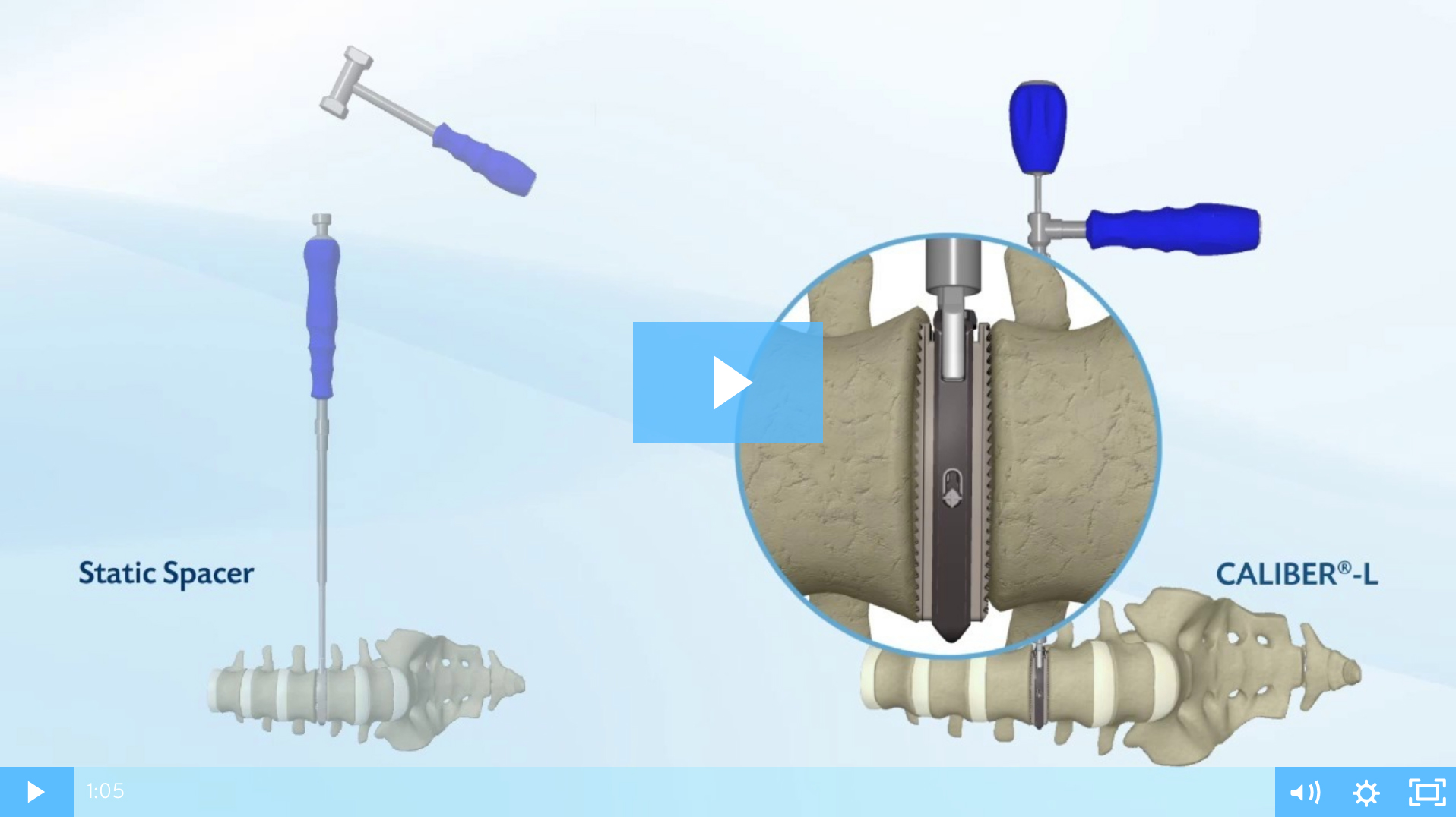 CALIBER™-L Expandable LLIF Spacer
