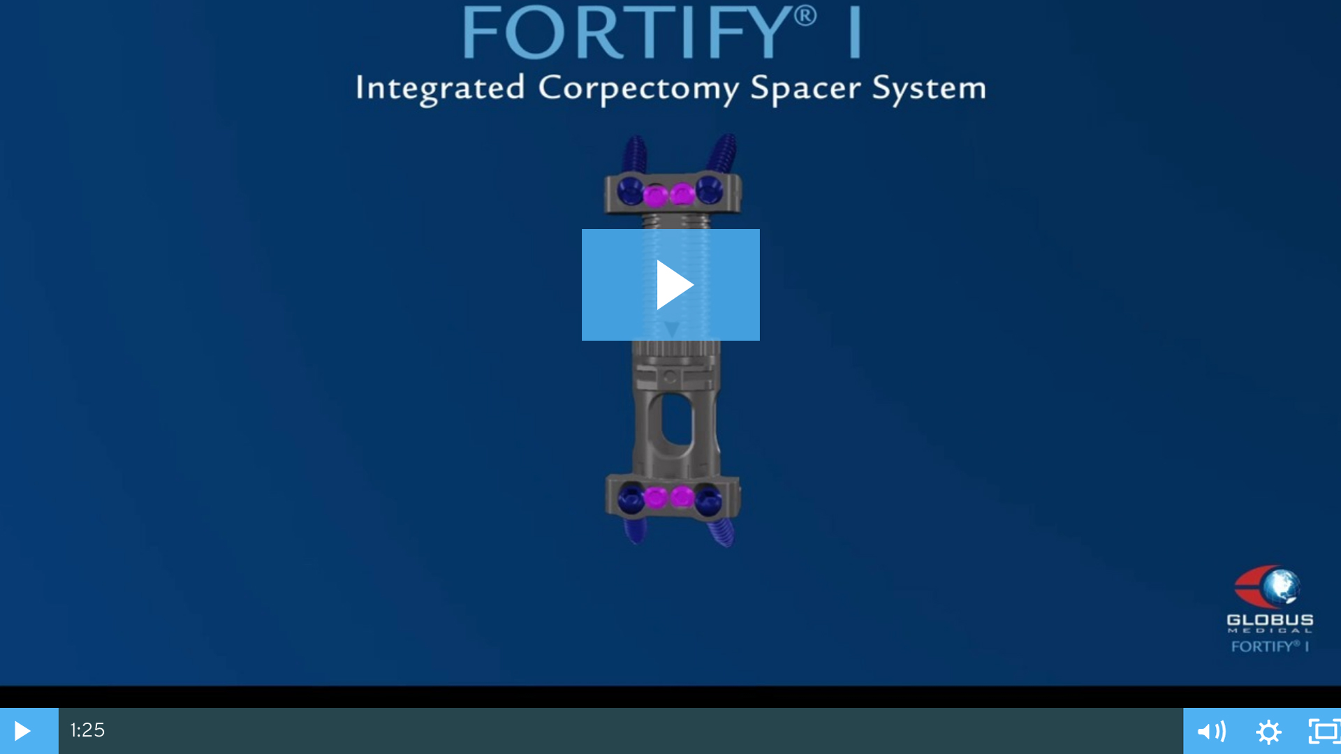FORTIFY®-I Expandable Integrated Corpectomy Spacer