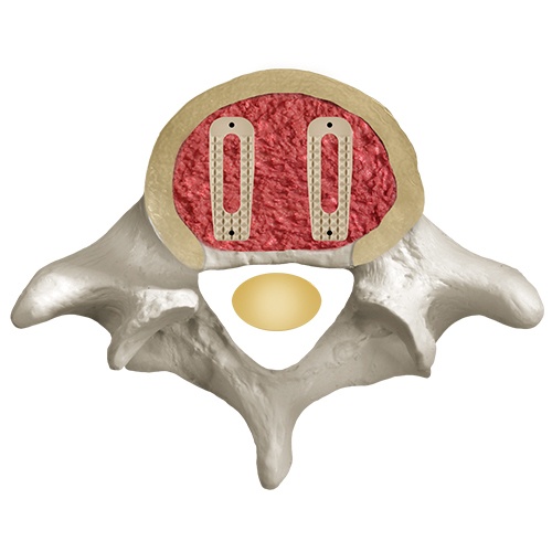 Posterior Spine