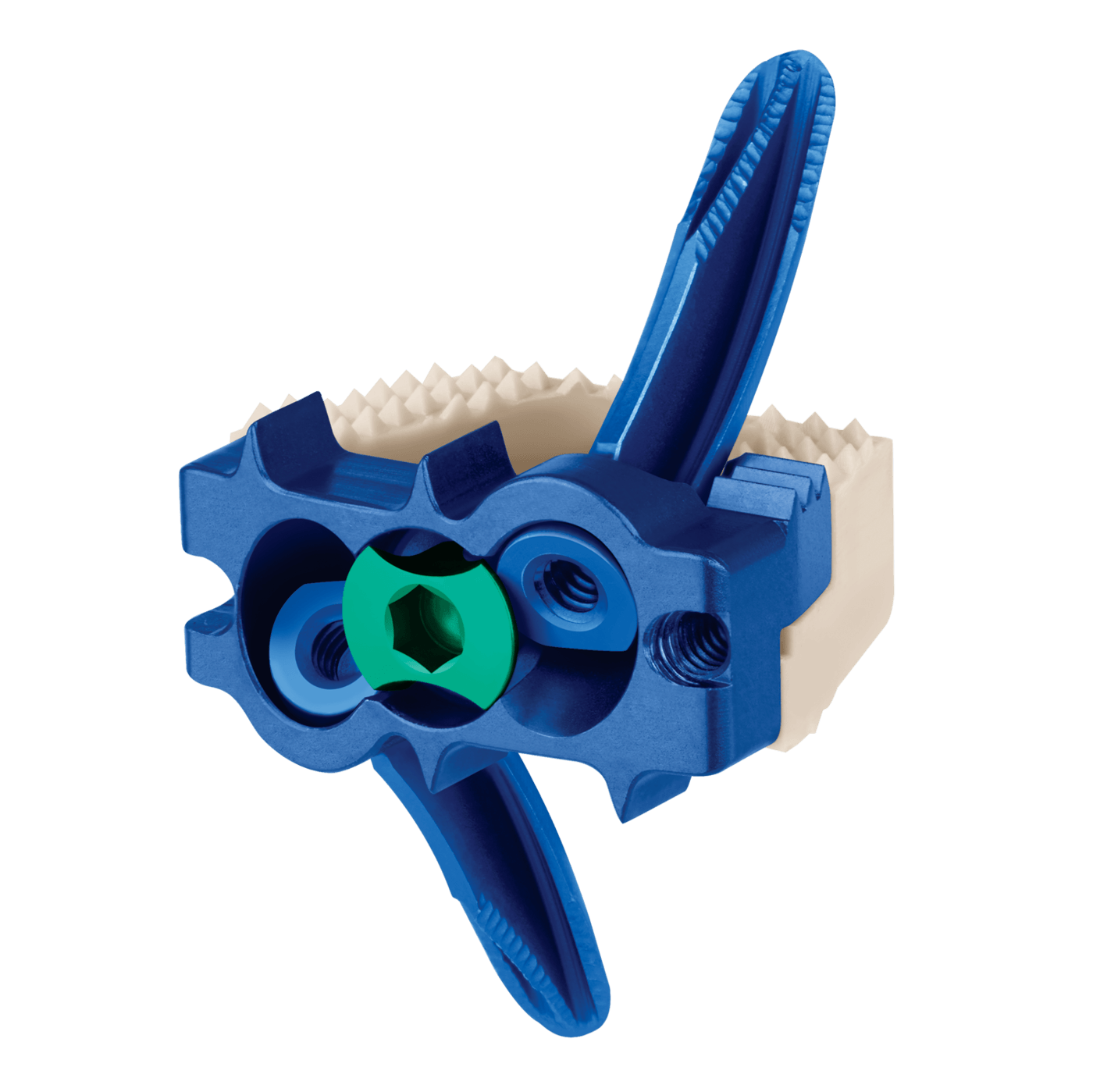 COALITION MIS® ACDF Spacer, All Anchors, Oblique View