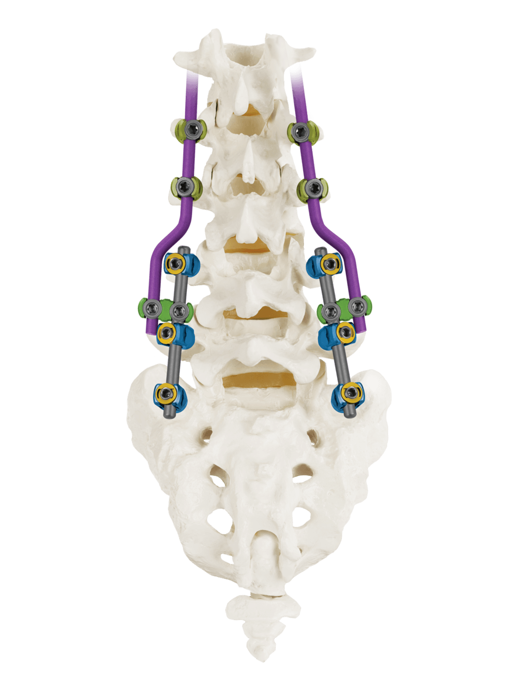 CREO® ADDITION™ Lateral Connector Double Head