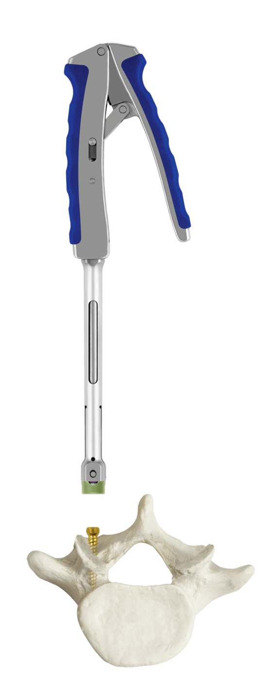 CREO® AMP Tulip Insertion