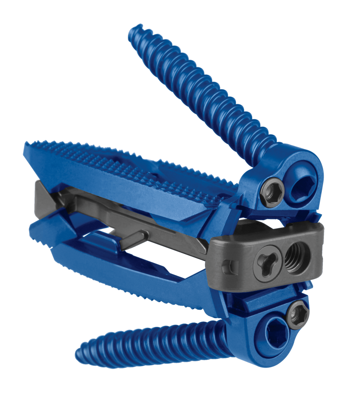 ELSA® Expandable-Integrated Lateral Interbody Spacer, Expanded 20 Degrees with Screws, Oblique View