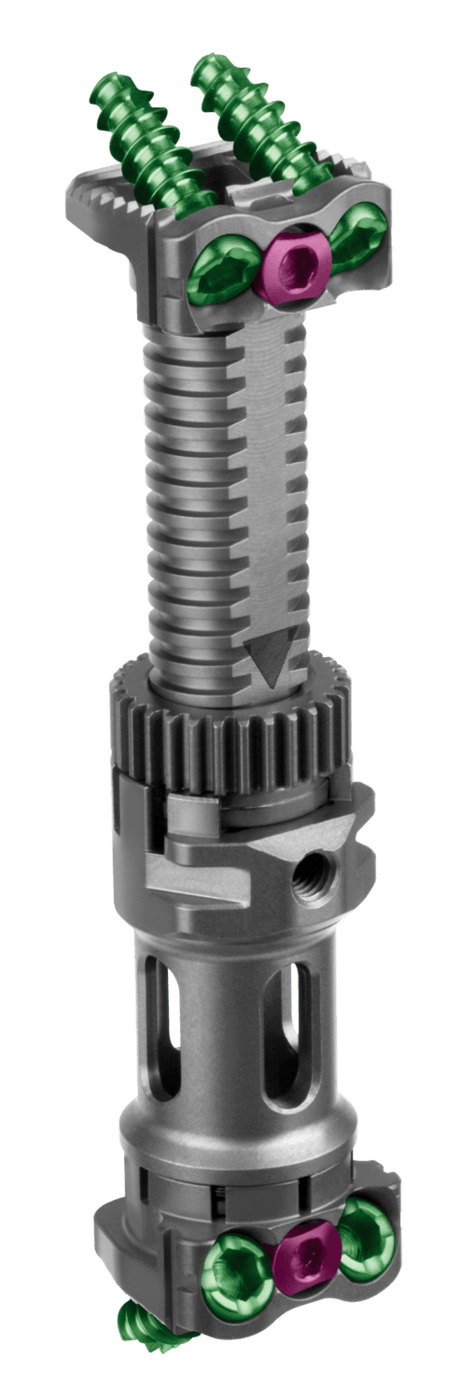 FORTIFY®-I Small Implant