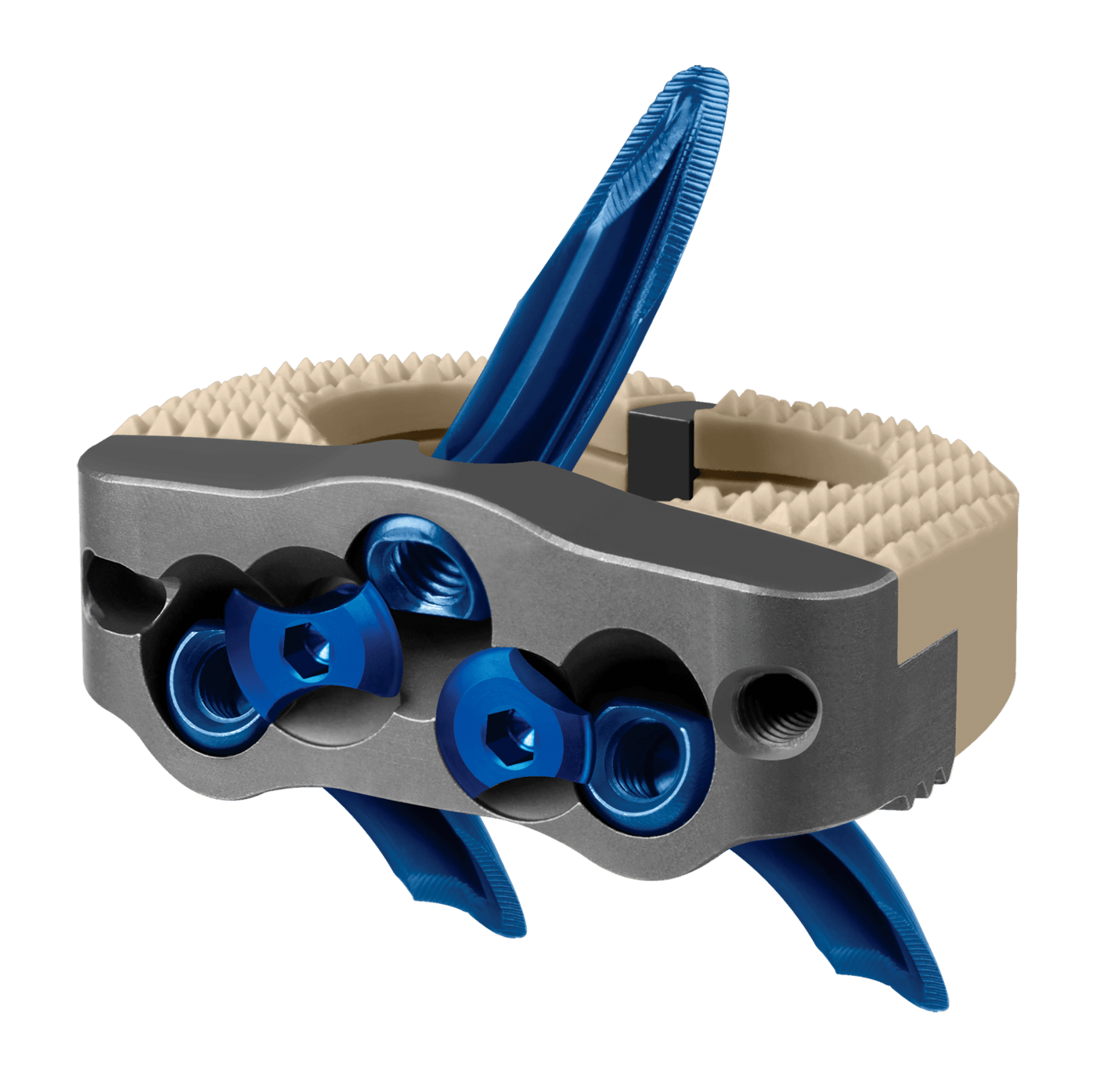 INDEPENDENCE MIS® 26x34mm Implant with Anchors, Oblique View