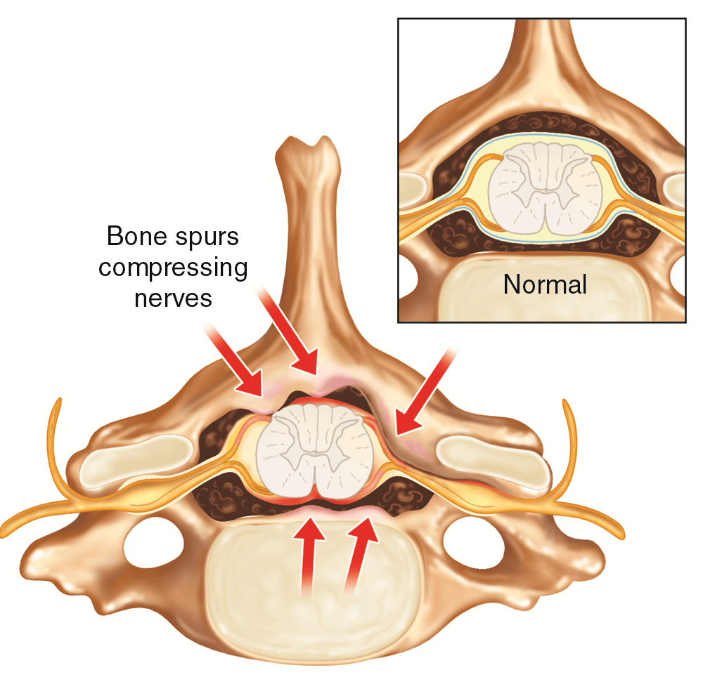 Axial view of the cervical spine