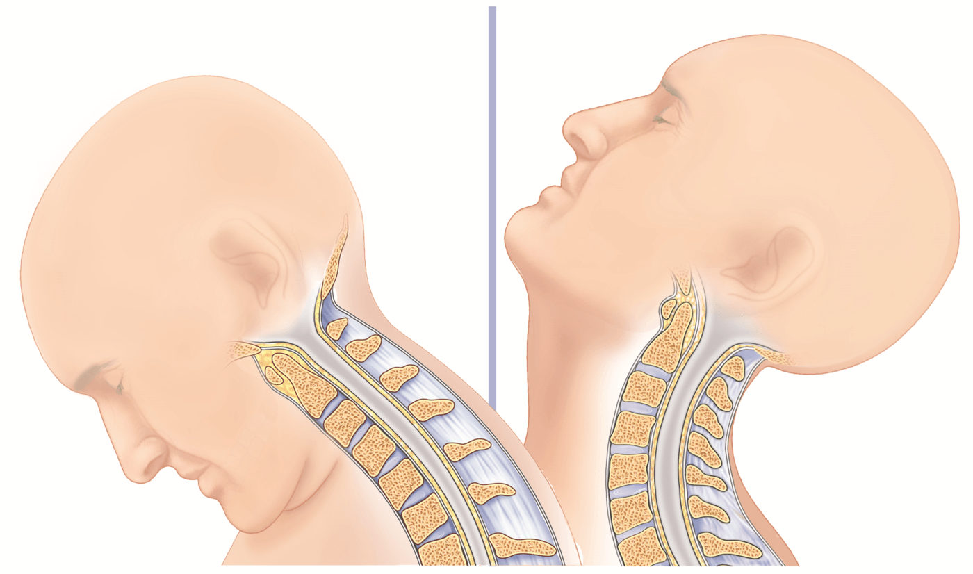 Flexion and Extension