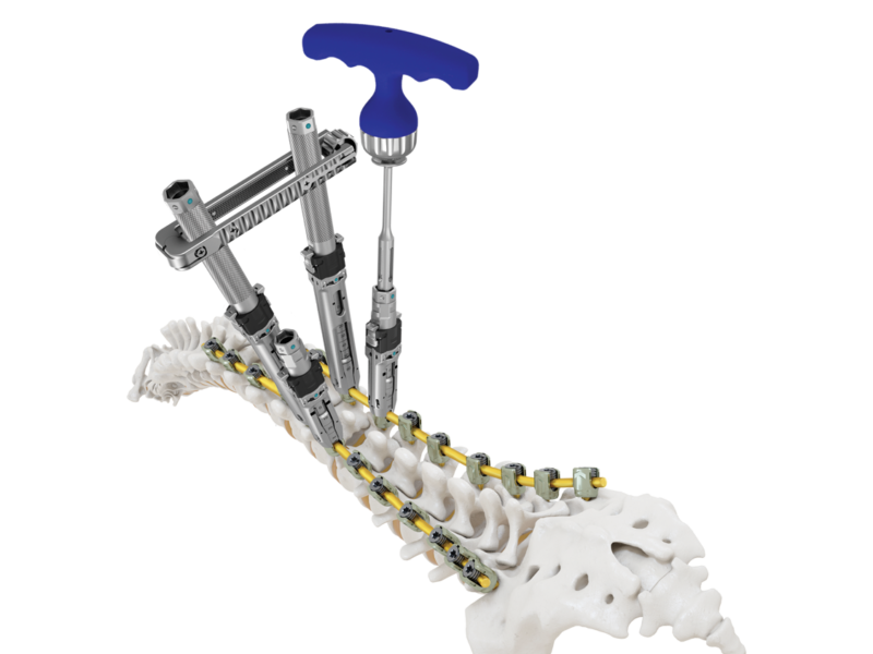 CREO DLX Stabilization System Full Length Bone Model