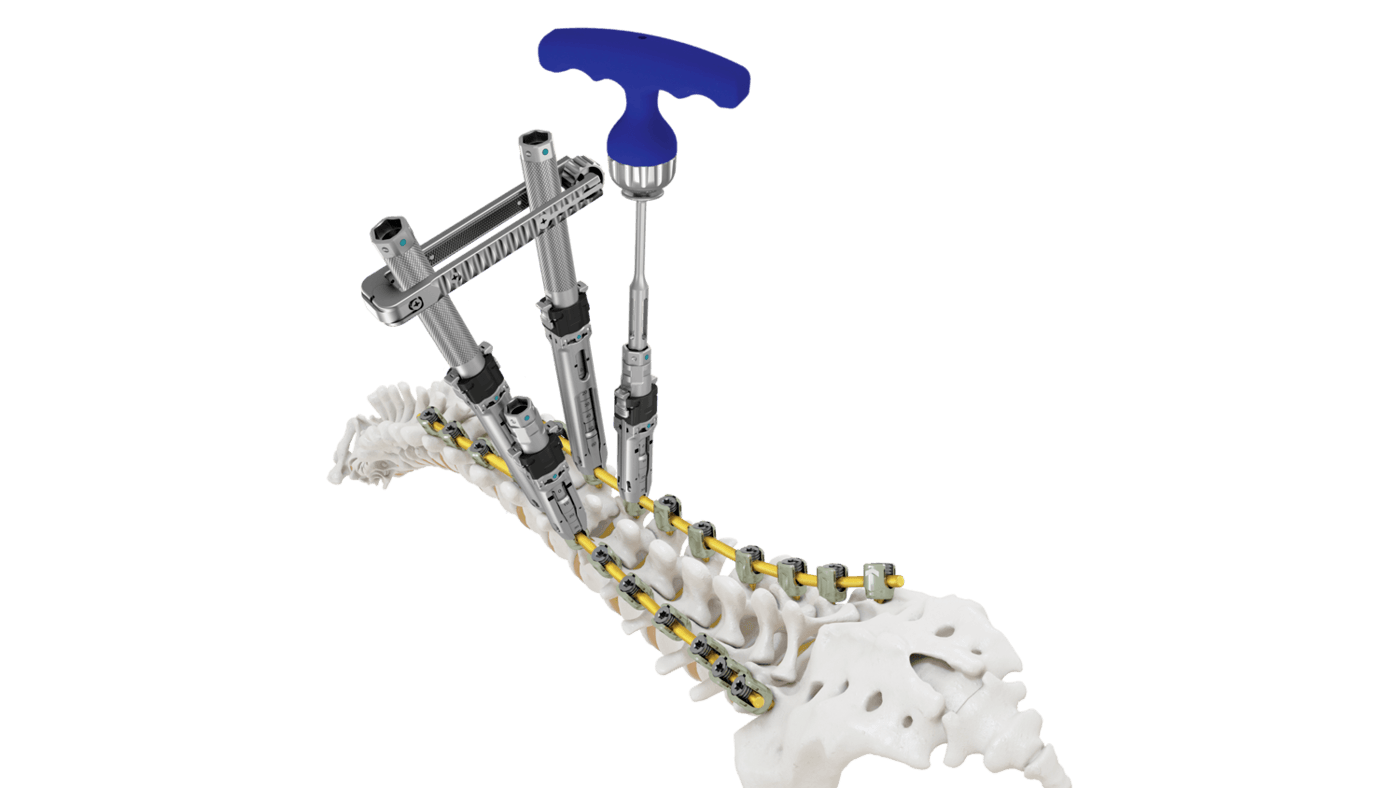 CREO DLX Stabilization System Full Length Bone Model