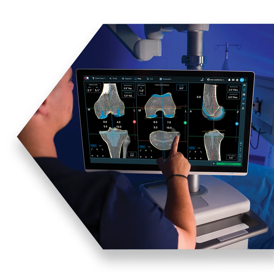 ExcelsiusFlex TKA — image 3