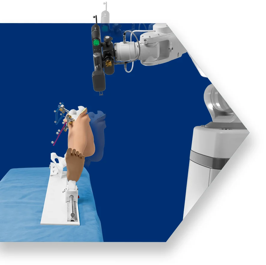 ExcelsiusFlex TKA — image 5