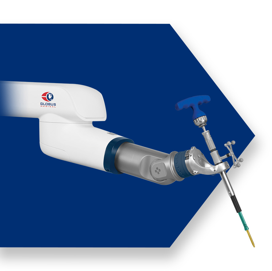 ExcelsiusGPS with pedicle screw