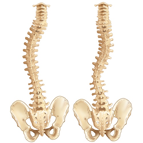 Scoliosis Curves