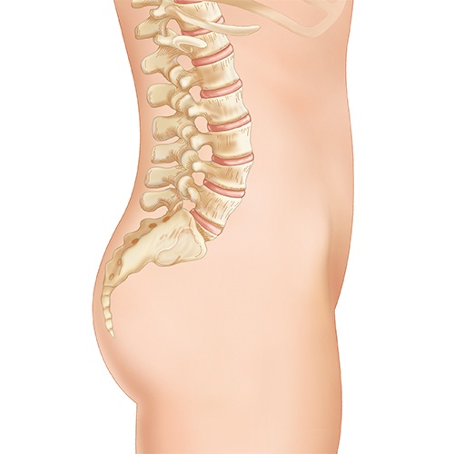 SI LOK incision site