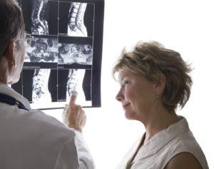 Doctor and patient discussing spinal x-ray
