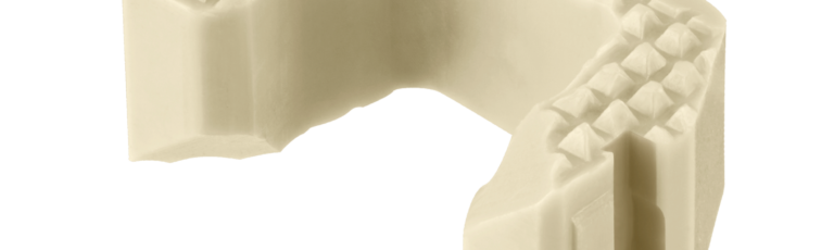 COALITION AGX® ACDF Peek Spacer, Oblique View