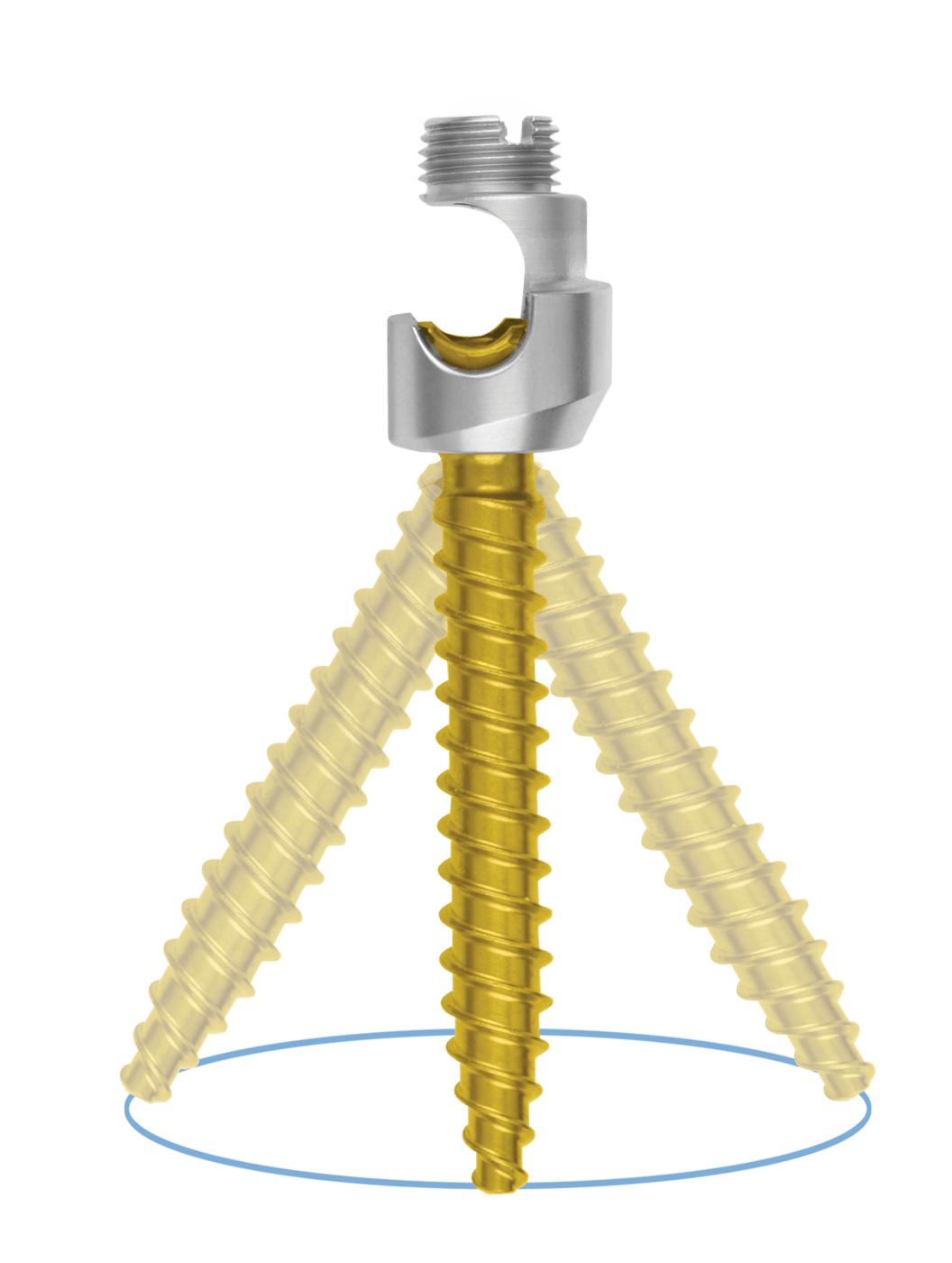 CREO® Side Loading Polyaxial Screw