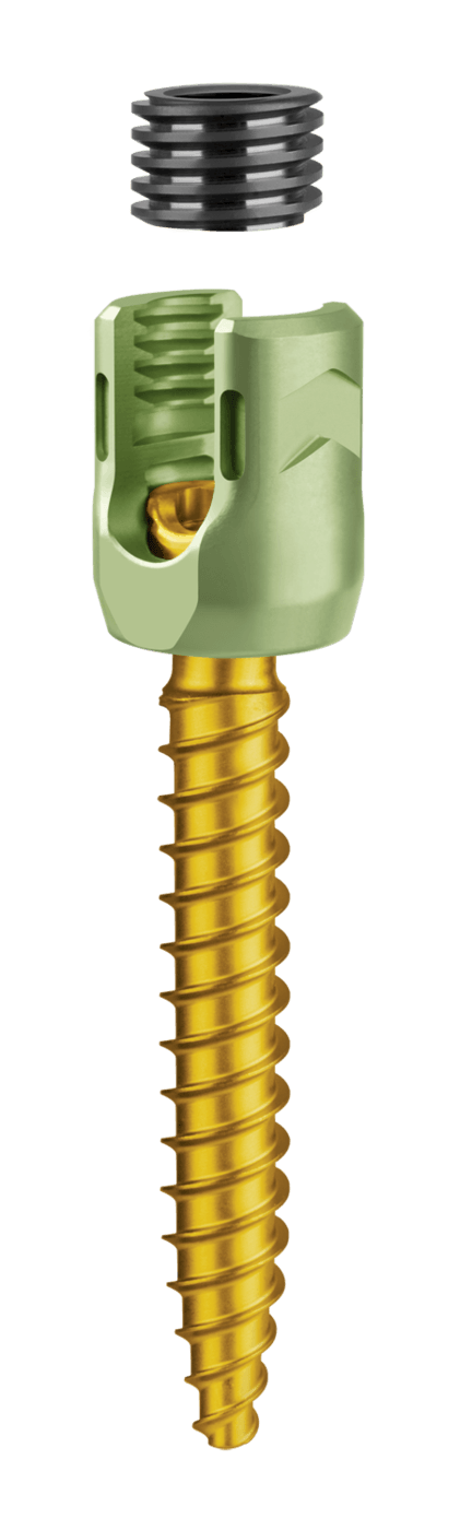 CREO® Threaded 65x35mm Polyaxial Screw, Exploded Screw Cap, Oblique View