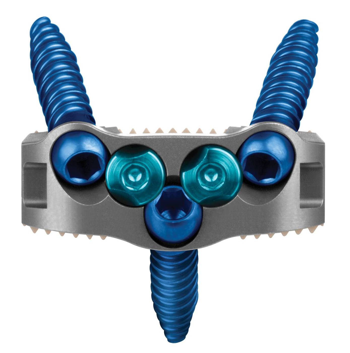 INDEPENDENCE® Integrated ALIF Spacer, Anterior View