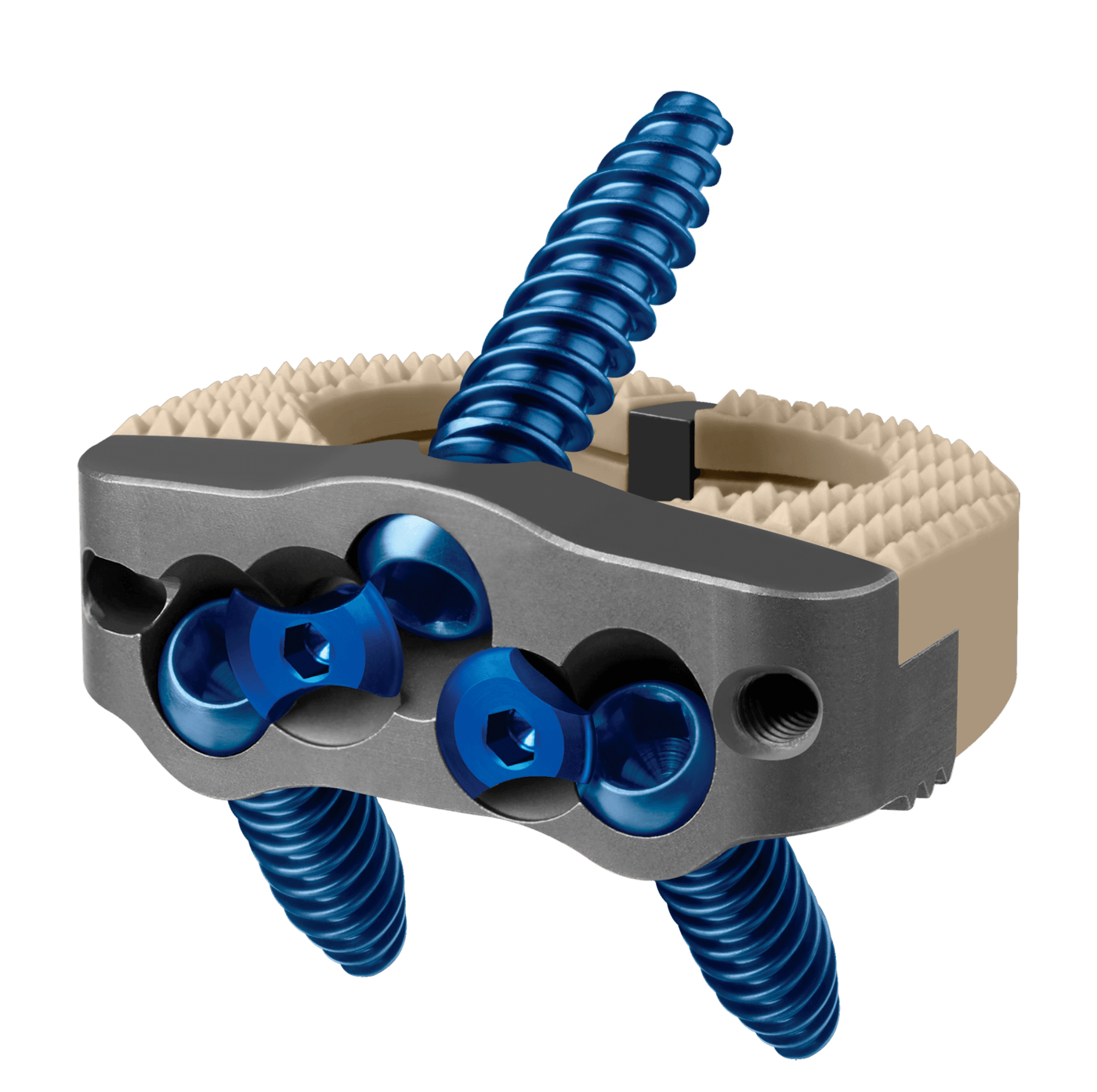 INDEPENDENCE MIS® Integrated ALIF Spacer