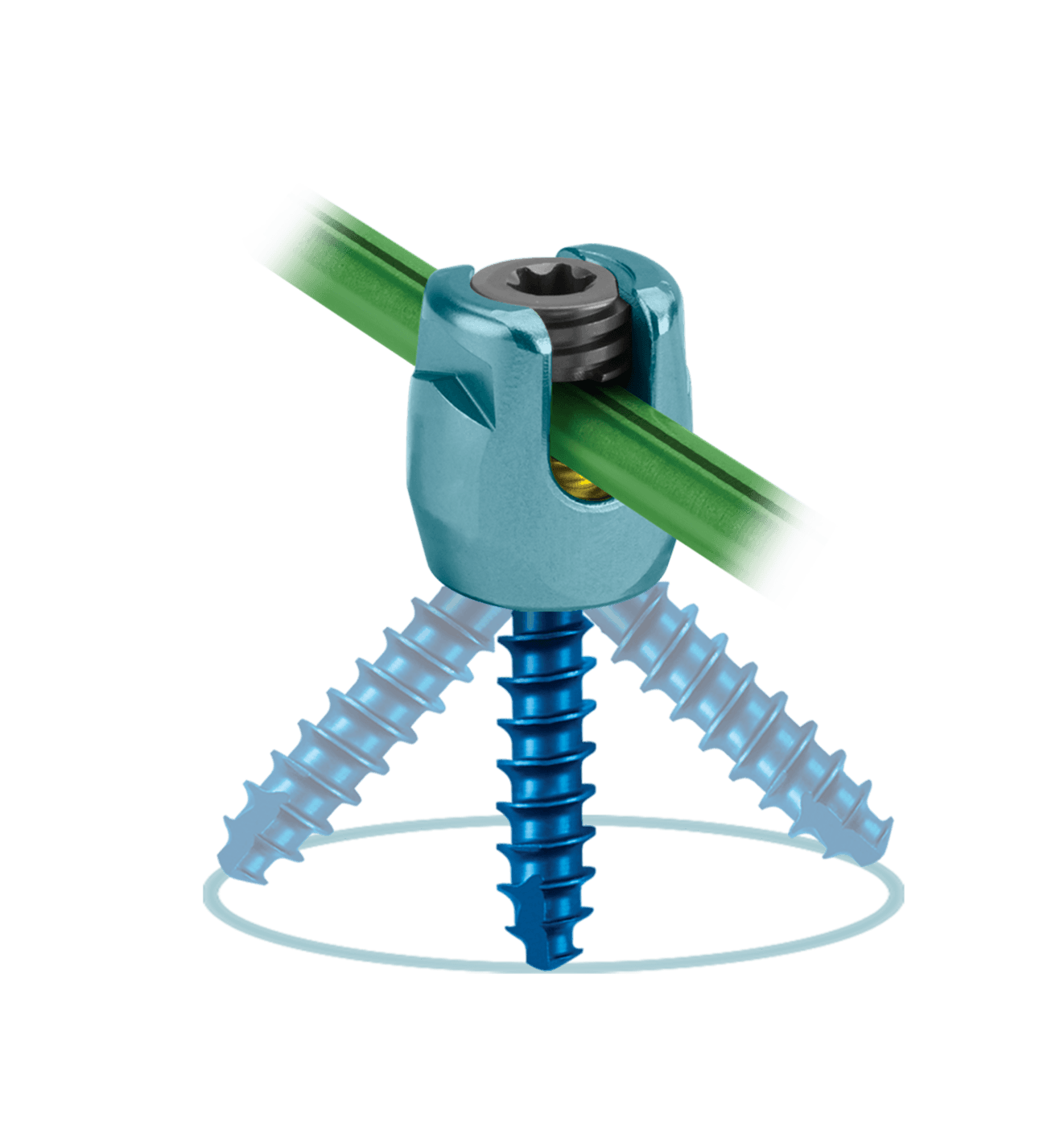 QUARTEX® Posterior Cervical, Fully Seated Locking Cap and 4mm Rod