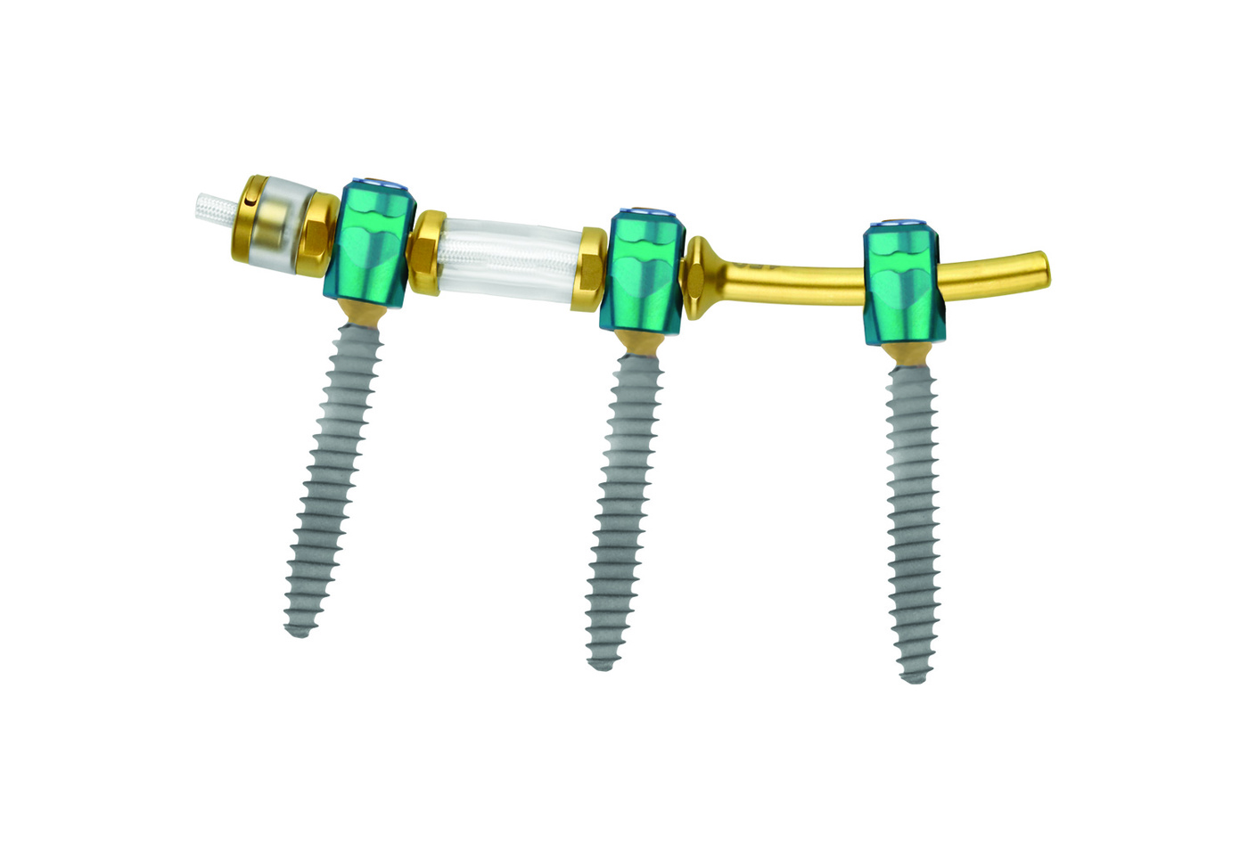 Transition® Stabilization System Two Level Screws
