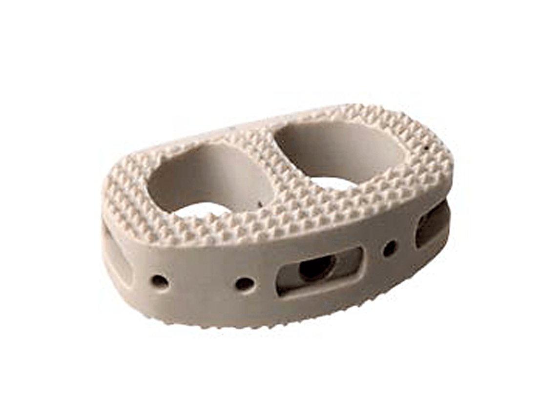 CONTINENTAL® ALIF Spacer Globus Medical