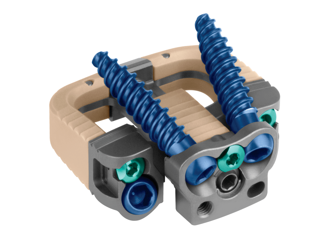 標本 P.N.G Ischiopsopha bennigseni 29mm MONUMENT™ Anterior Spondylolisthesis Reduction ALIF System