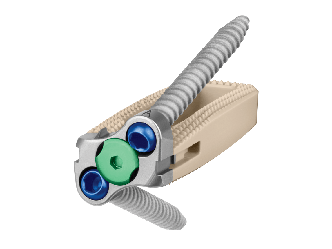 InterContinental Lateral Interbody Spacer Globus Medical