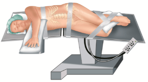 Patient on medical table in a front facing position