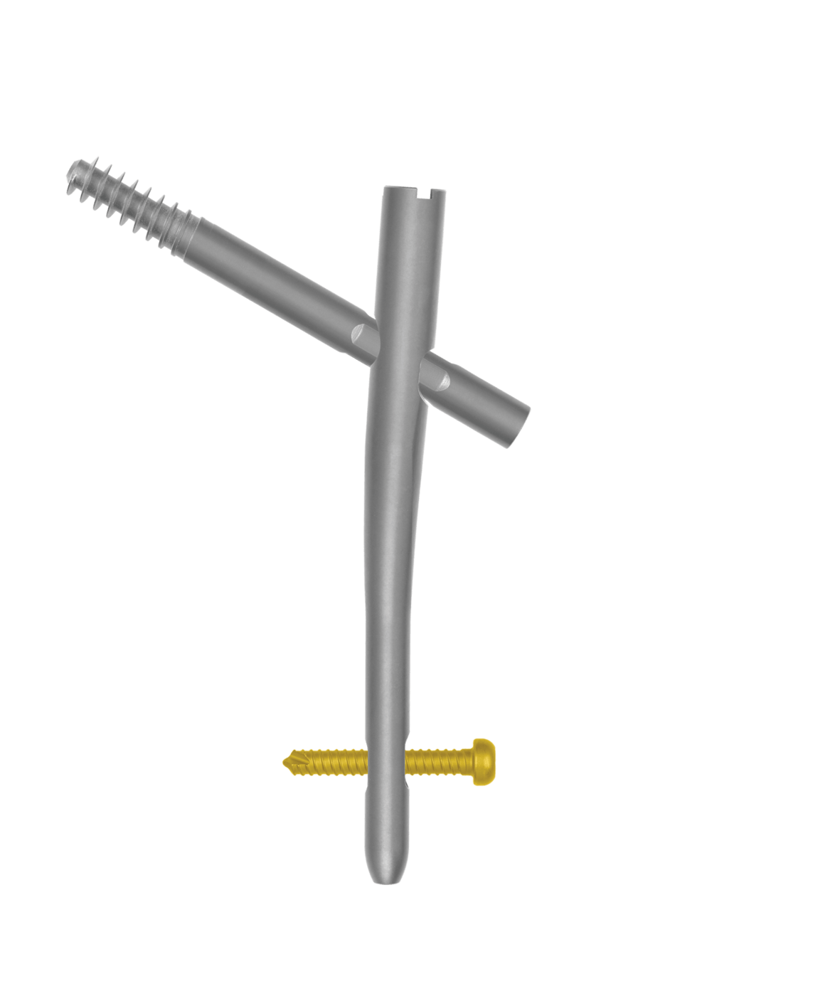 AUTOBAHN® Trochanteric Nailing System | Globus Medical