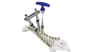 CREO DLX Stabilization System Full Length Bone Model