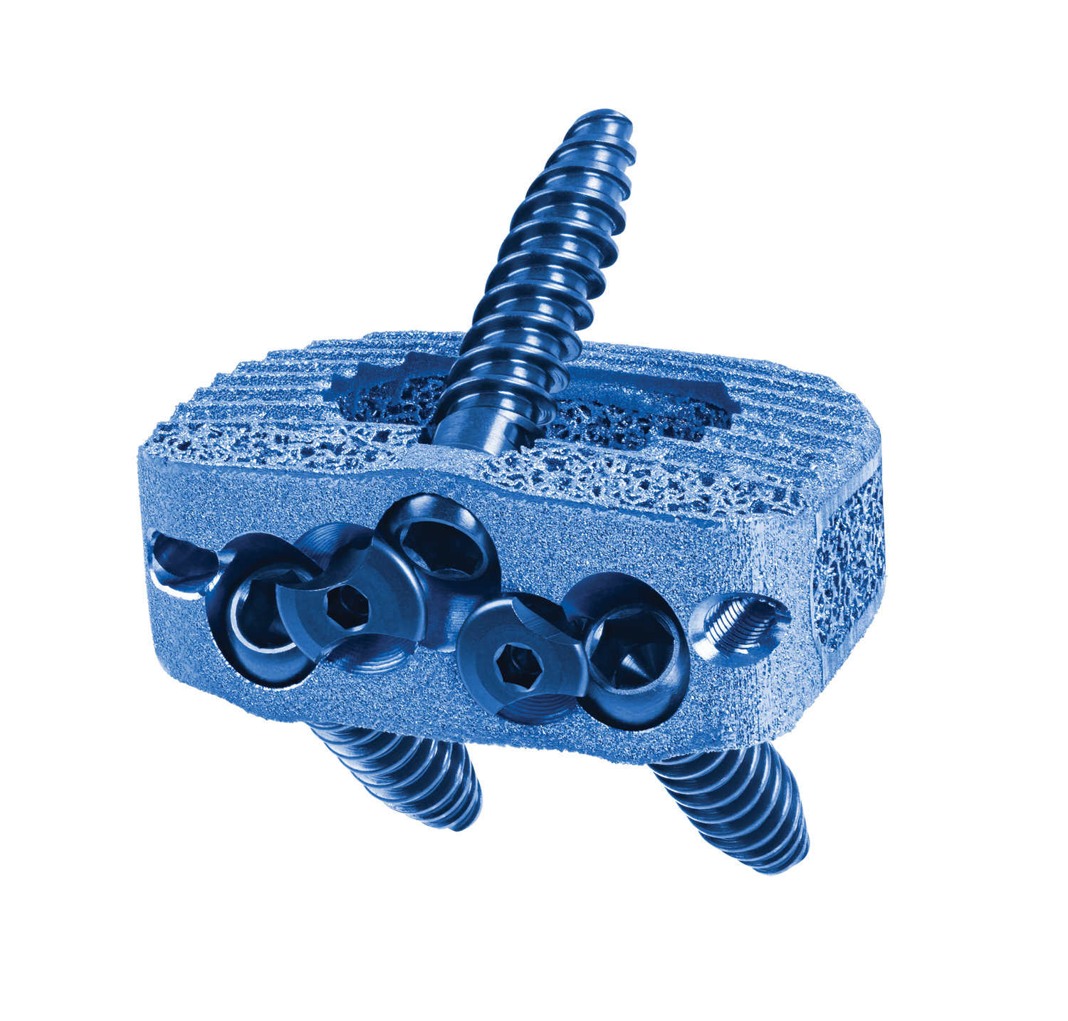 HEDRON IA Spacer with screws