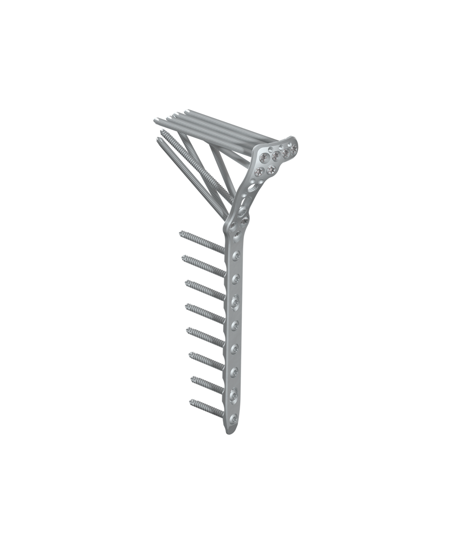 Extra-Caliber (carbon fiber) Radiolucent Tibia/Ankle System