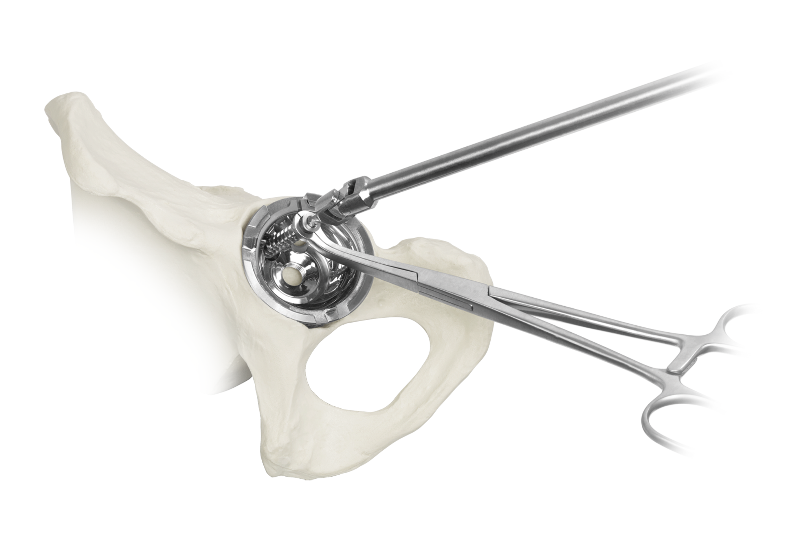 Metal Liner Components Of R3 Acetabular System – RXFRF