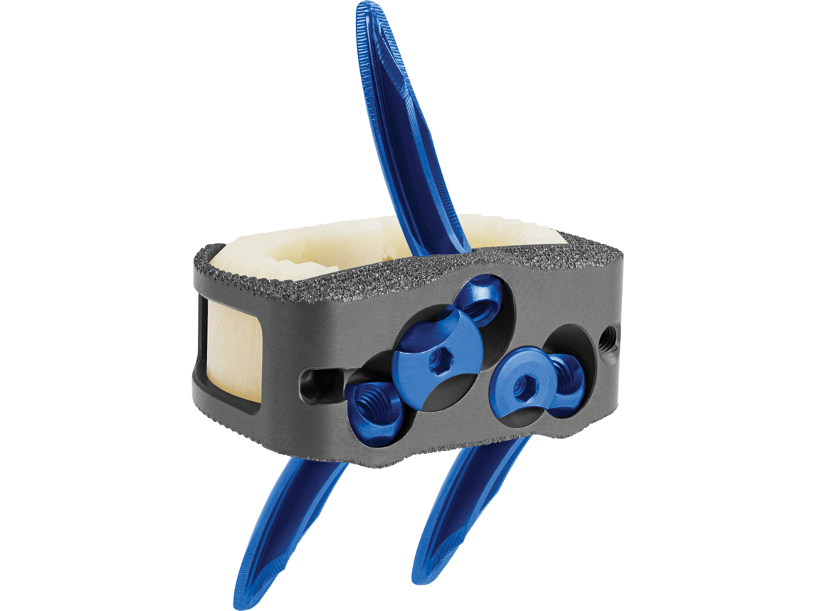 INDEPENDENCE MIS AGX™ Integrated ALIF Allograft Spacer