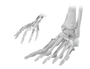 ANTHEM hand and food