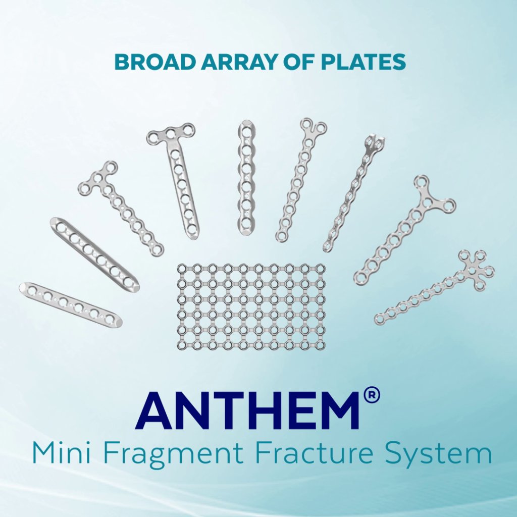 ANTHEM Mini Fragment Fracture System