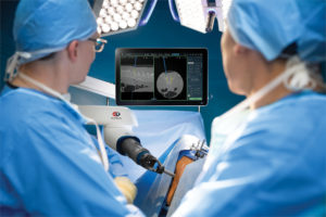Surgeons looking at ExcelsiusGPS screen