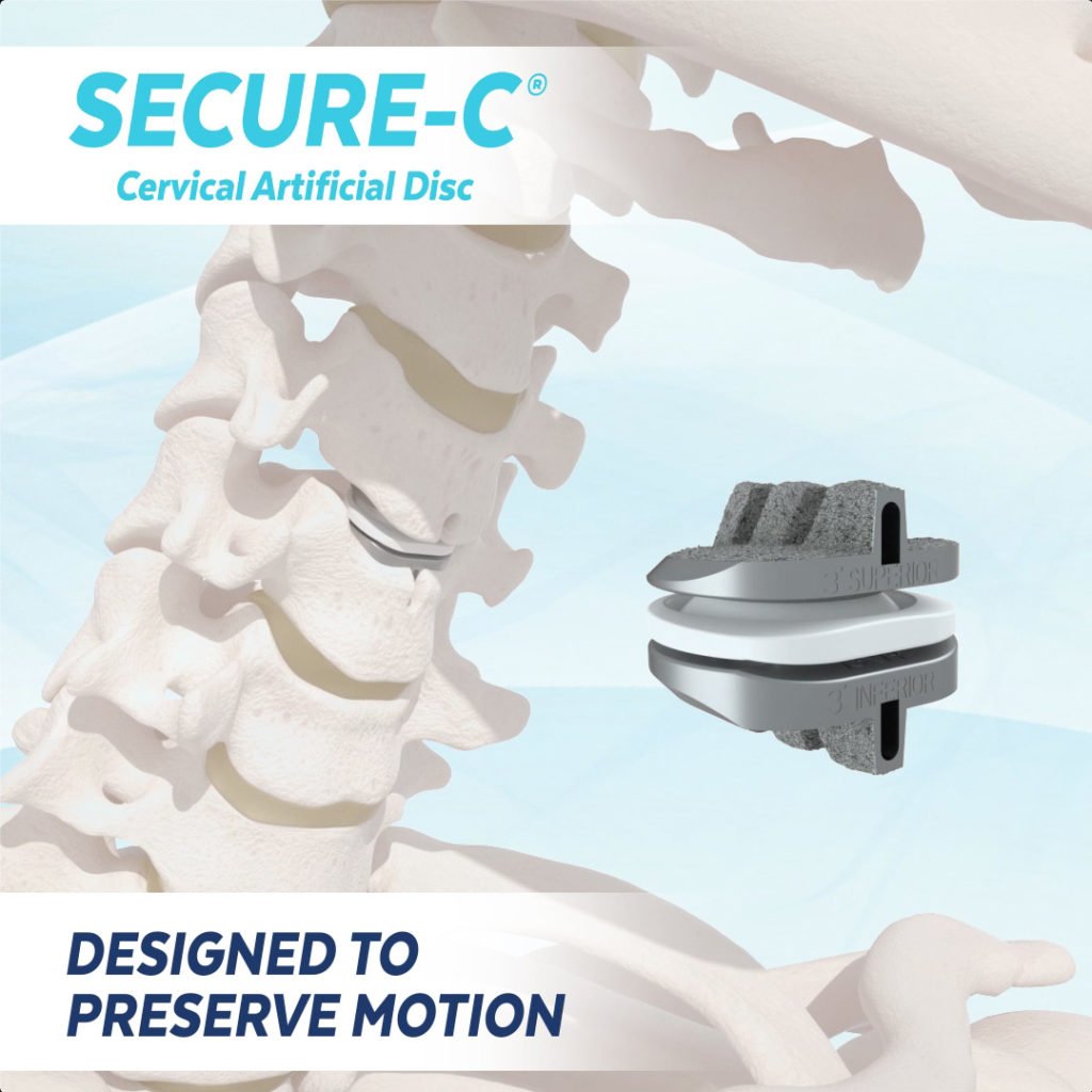 SECURE-C Cervical Artificial disc
