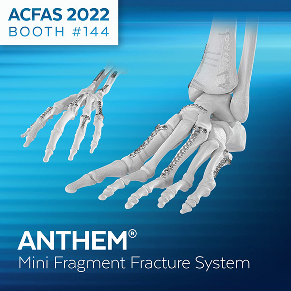 ANTHEM Mini Fragment Fracture System at ACFAS 2022