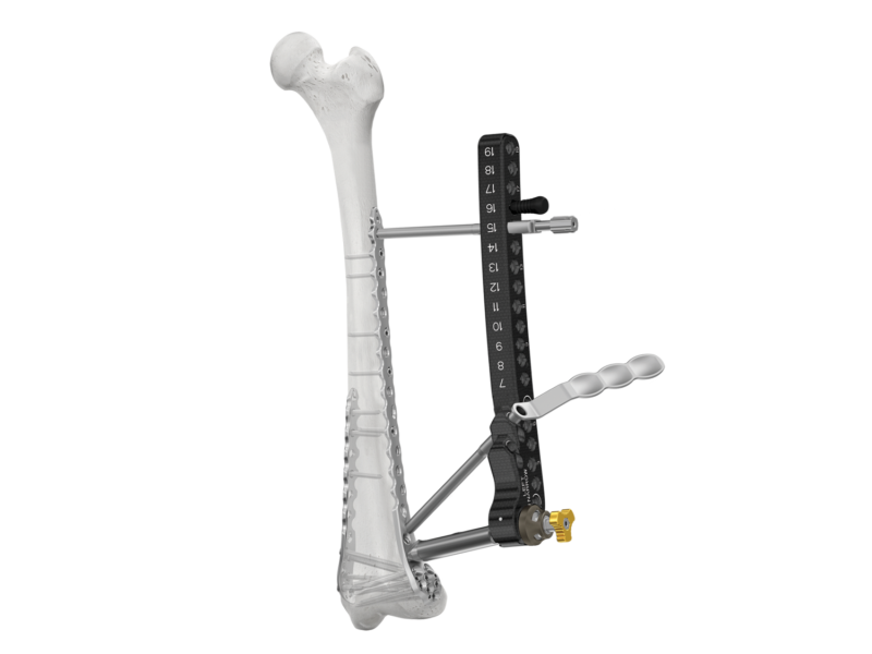 ANTHEM Distal Femur