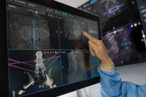 Planning procedure on ExcelsiusGPS screen