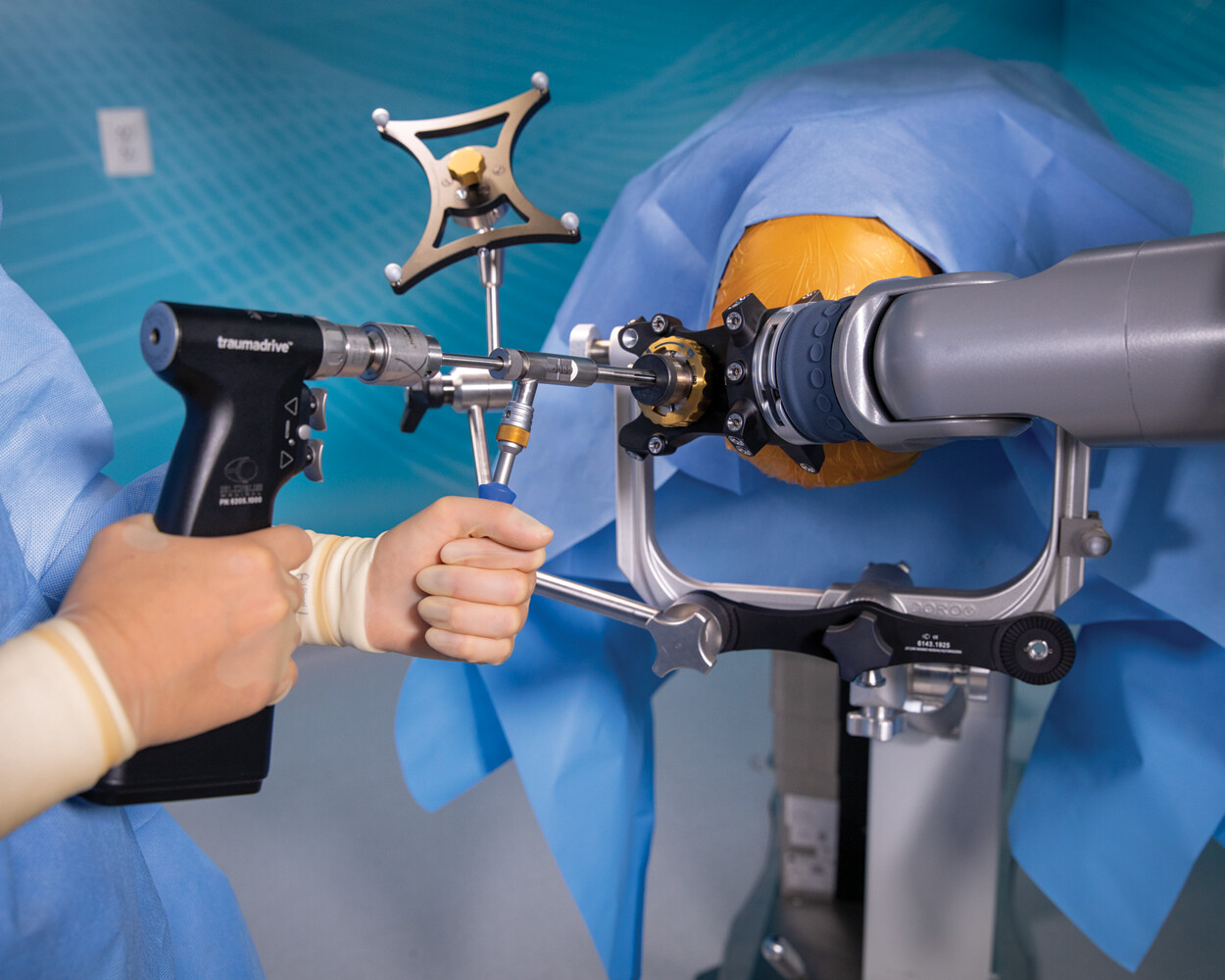 Top 5 Ways Excelsius™ Cranial Solutions Will Revolutionize Your OR