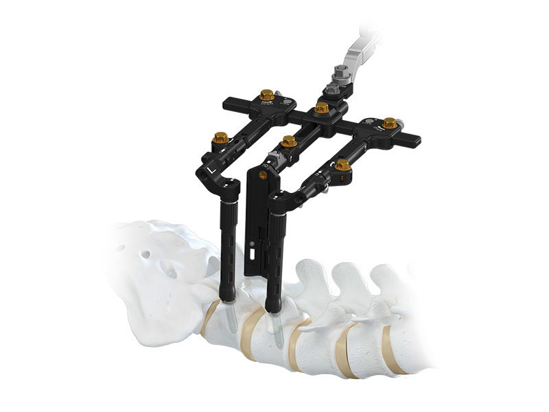 MARS TLIF Retractor with spine