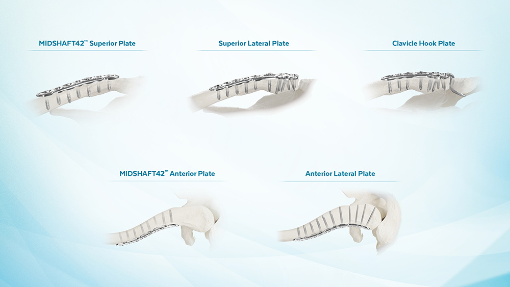 ANTHEM Clavicle plates