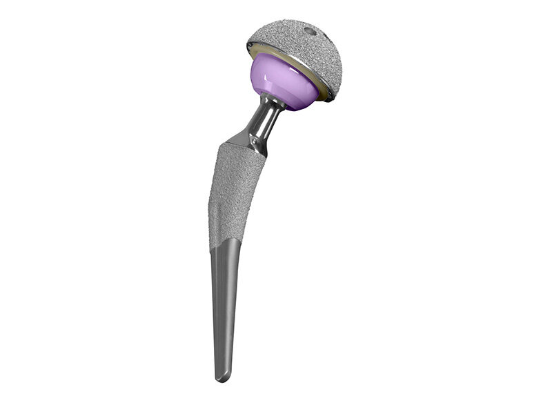 Provident hip stem with ONVOY shell